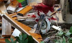Bacağını elektrikli testereye kaptıran yaşlı adam ağır yaralandı, olayı haber alan torun gözyaşlarına boğuldu