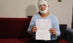 Güzelleşmek uğruna gittiği merkezde yüzü yandı