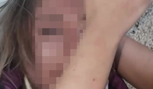 Genç kızı darp edip özür dilettiler, o anları sosyal medyada paylaştılar