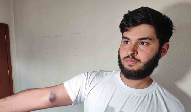 Conolar hem topu vermedi hem de aileye sopalı silahlı saldırıda bulundu