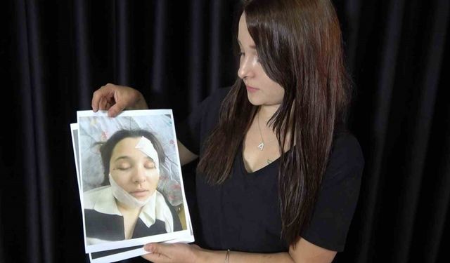 Eski sevgilisi tarafından öldüresiye darp edilen genç kadın yaşadığı kâbusu anlattı