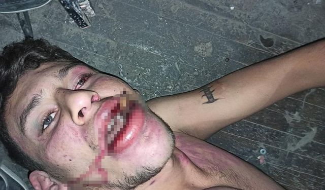 Hamam böceği yedirilen gencin dosyasında karar: Yağmadan beraat, hürriyeti tehditten 6 yıl 12 ay ceza