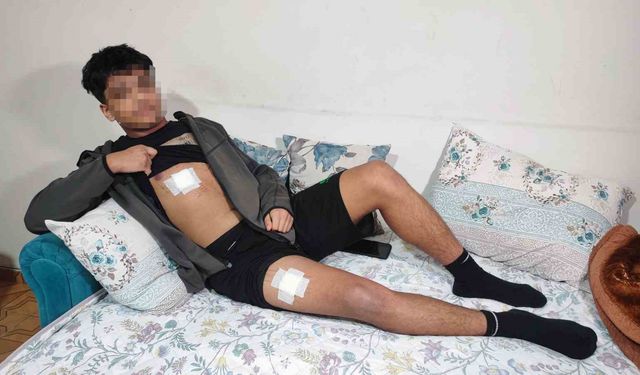 Akran zorbalığı az kalsın öldürüyordu: Önce dövüldü sonra bıçaklandı
