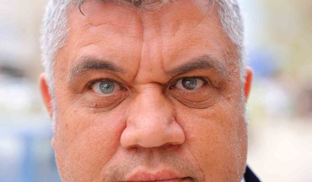 Kahramanmaraşlı adam 3 renkli gözleriyle görenlerin ilgisini çekiyor