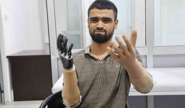 Demirin elektrik tellerine değmesiyle hayatı kararan Muhammed, 3 milyon TL değerindeki protez bacağına ve 2 biyonik koluna kavuştu