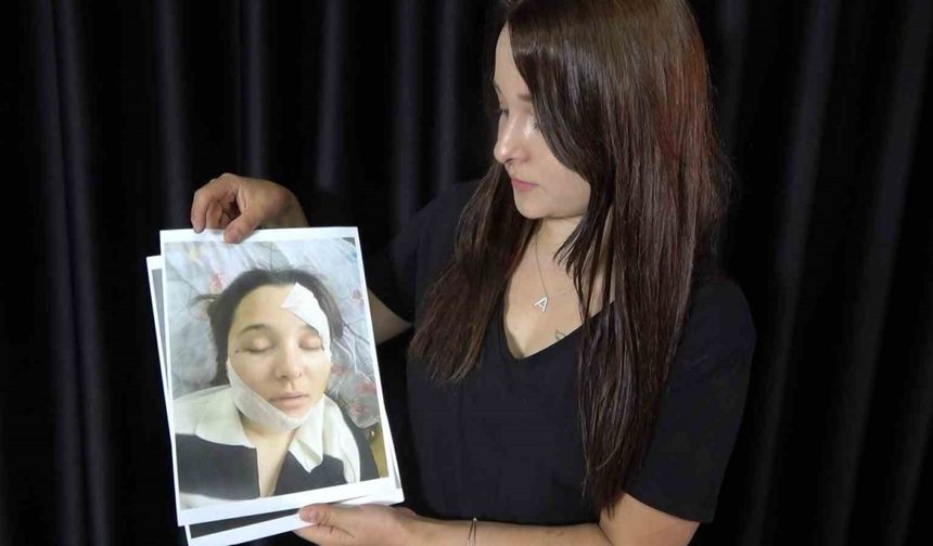 Eski sevgilisi tarafından öldüresiye darp edilen genç kadın yaşadığı kâbusu anlattı